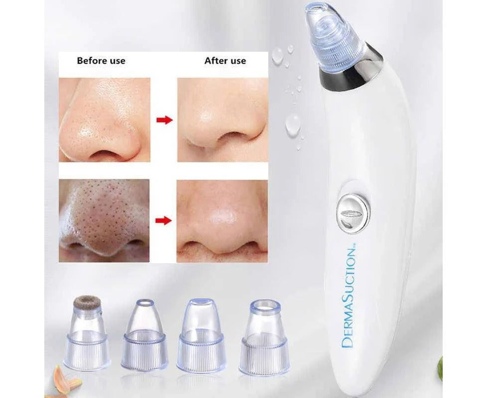 Derma Suction Vacuum Blackhead Remover Pore Cleaner Electric Nose Face Deep Cleaning Skin Care Machine Aspirator Point Skin Care Tool Beauty – (imported)